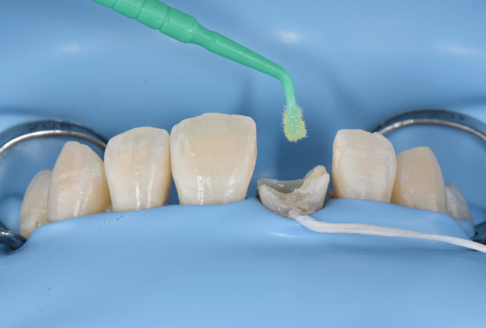 Case 1 - Foto 4