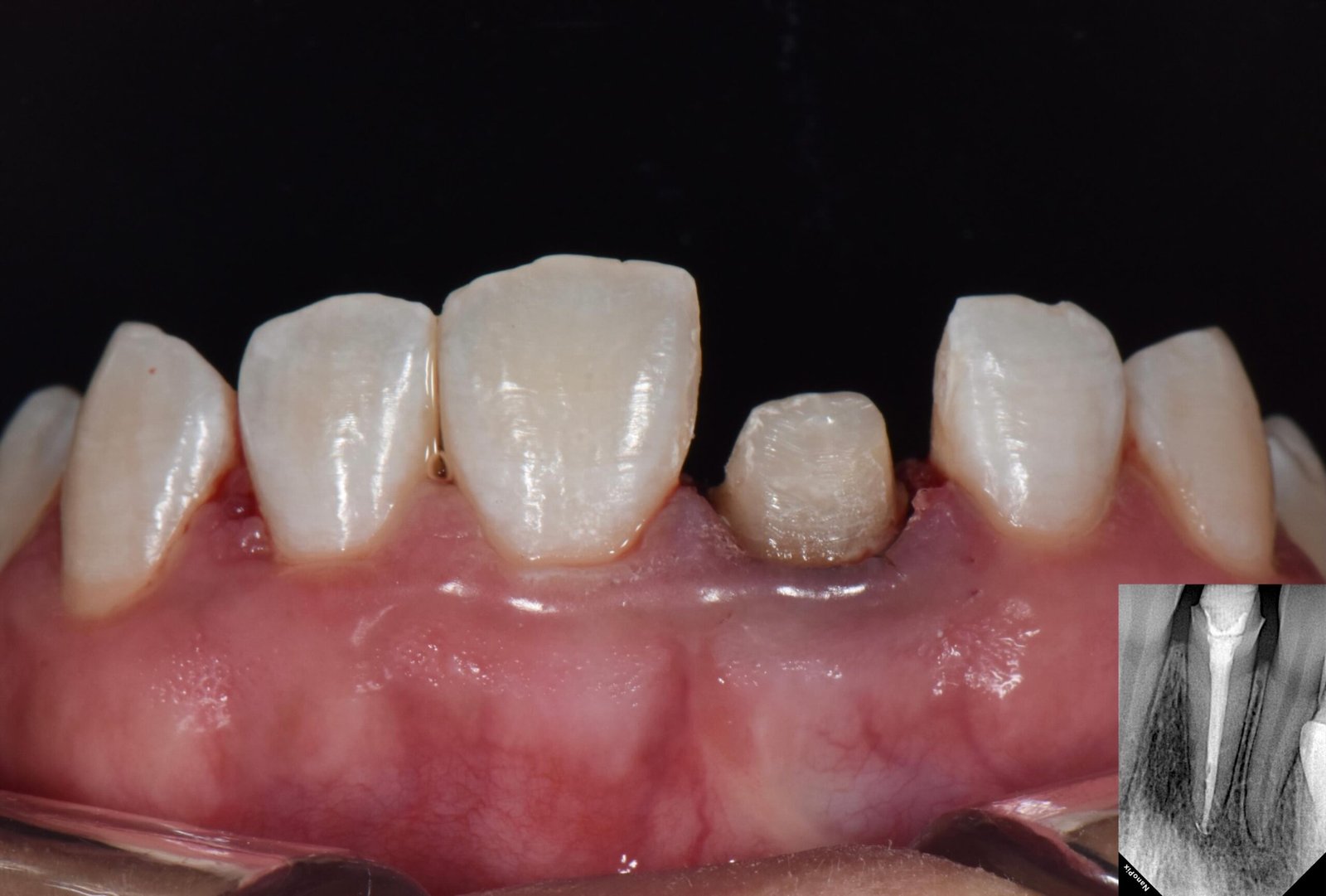 Case 1 - Foto 5