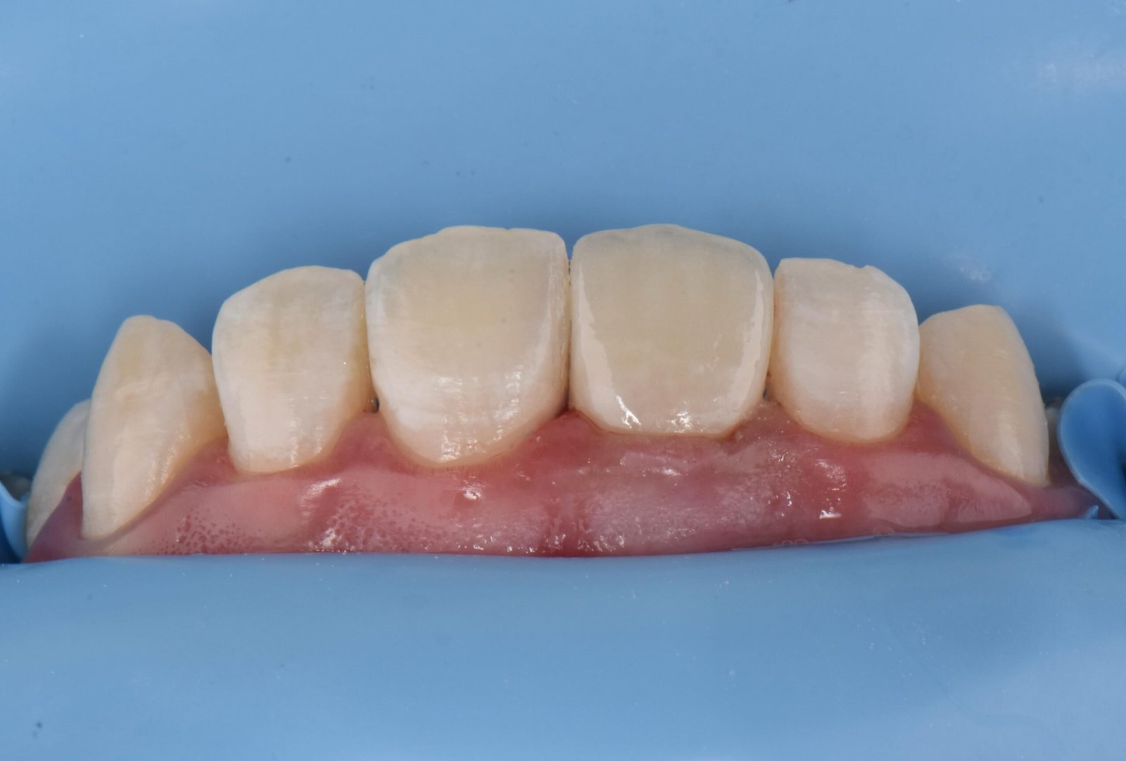 Case 1 - Foto 7