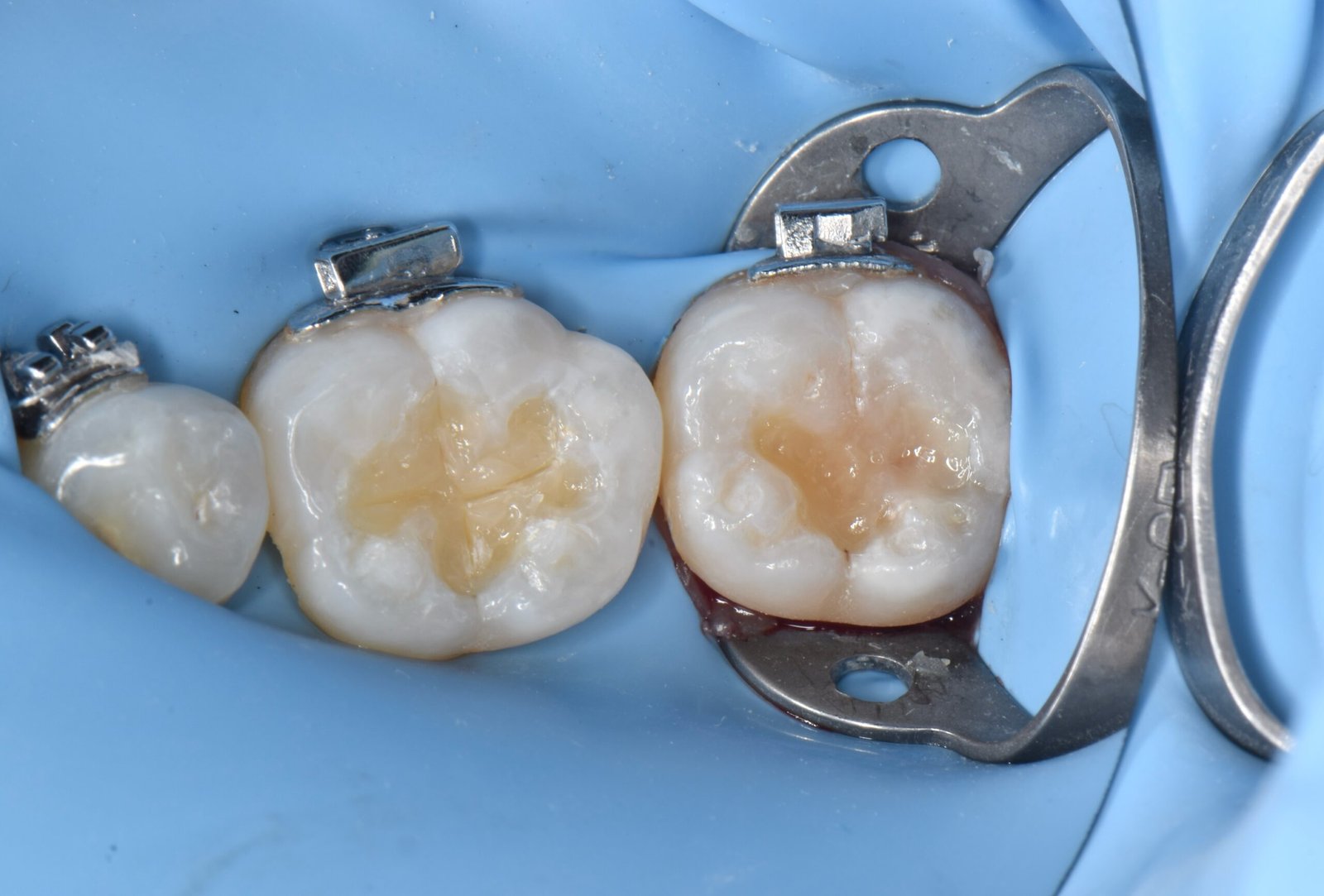 Case 2 - Foto 2