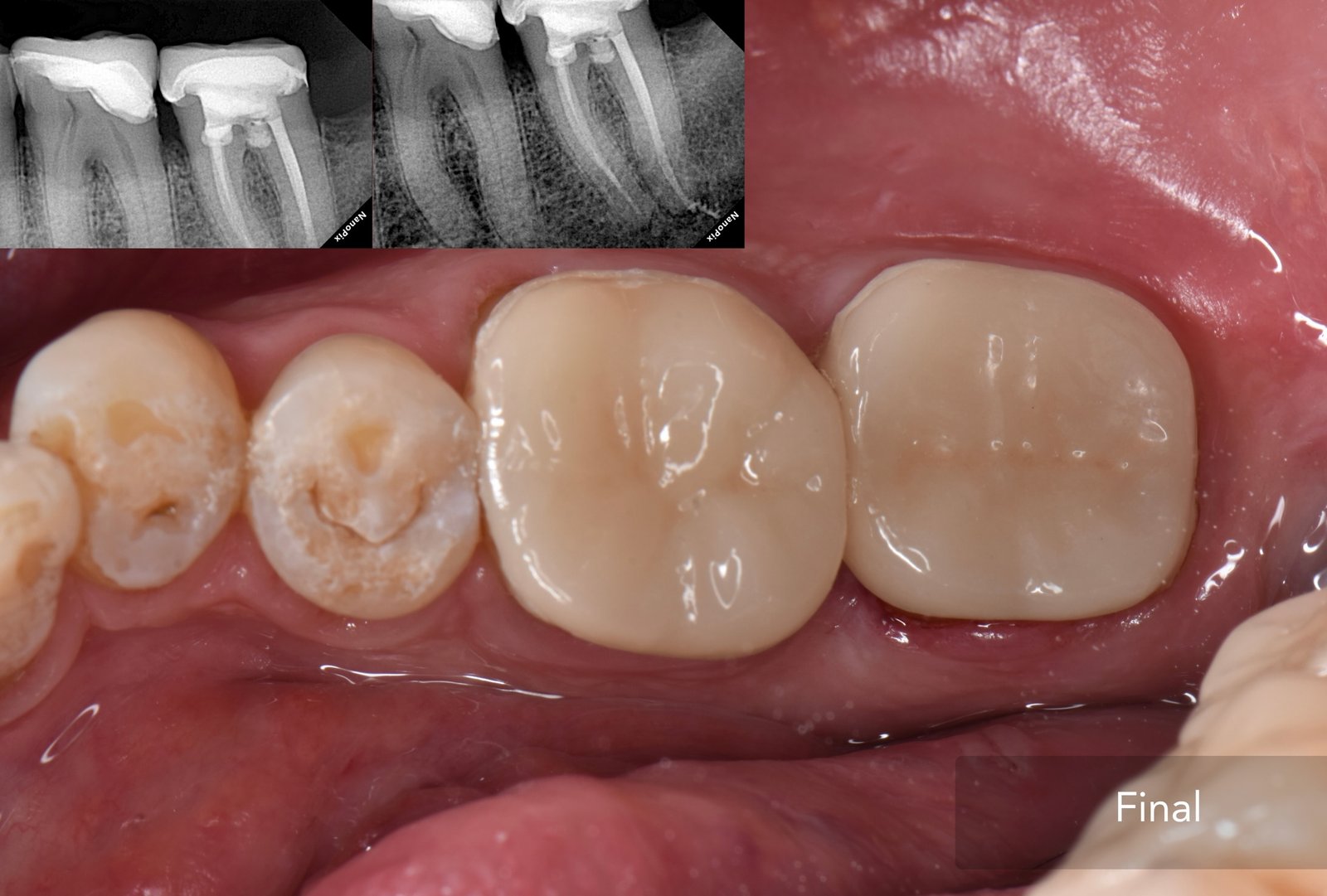 Case 2 - Foto 4