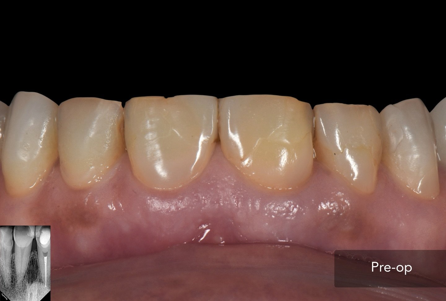 Case 2 - Foto 1