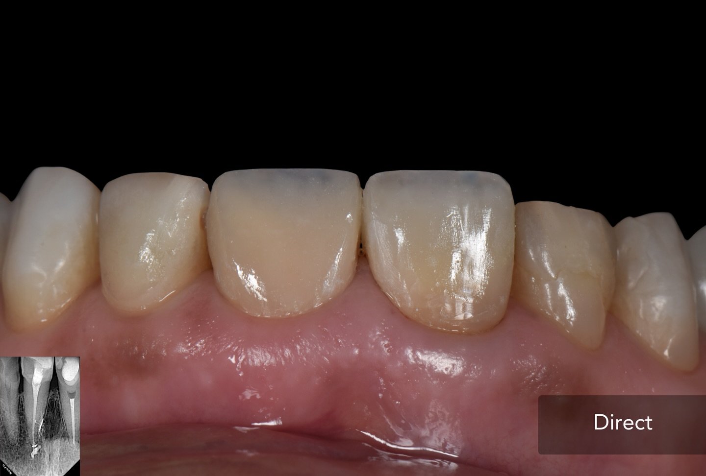 Case 2 - Foto 2