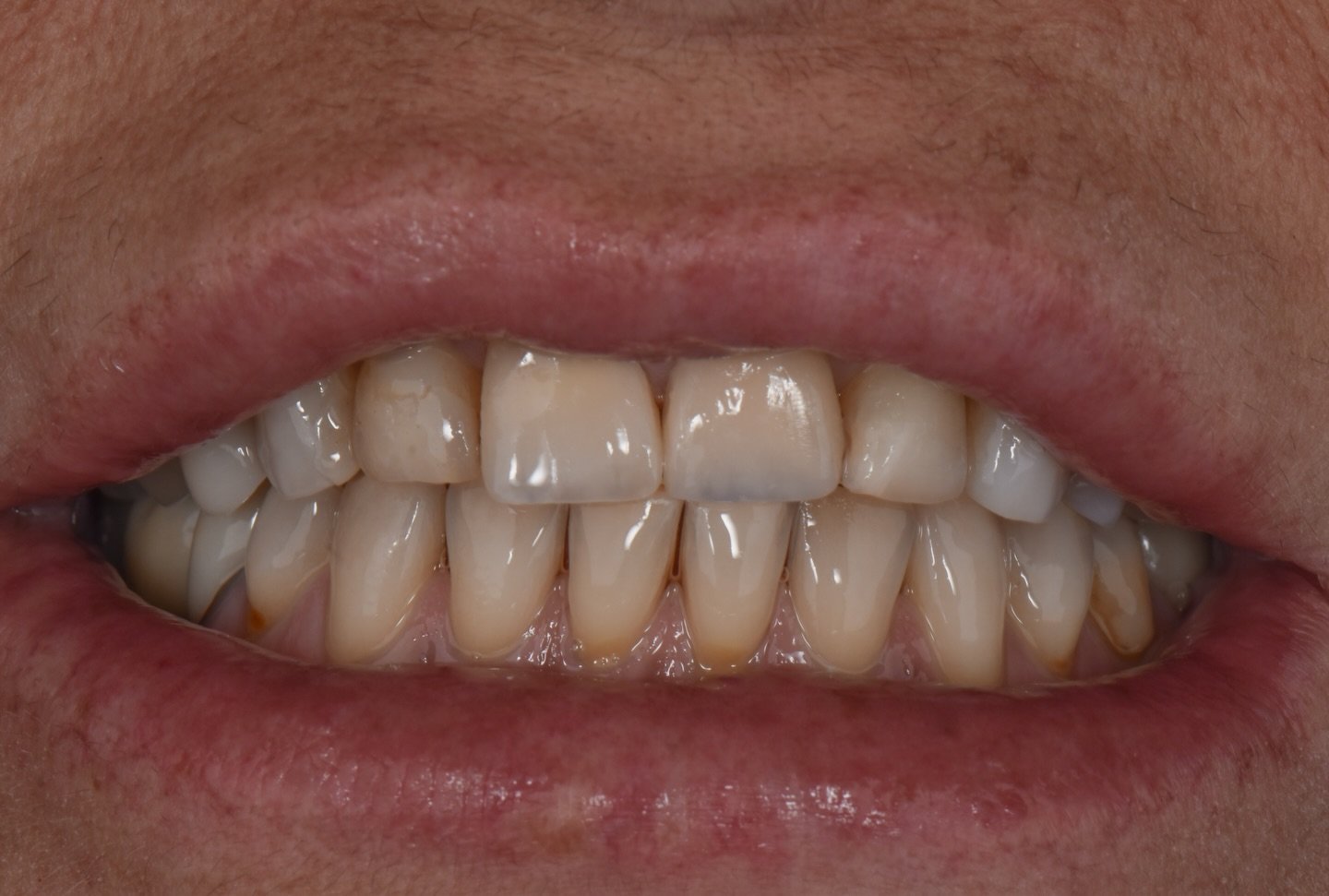 Case 2 - Foto 3